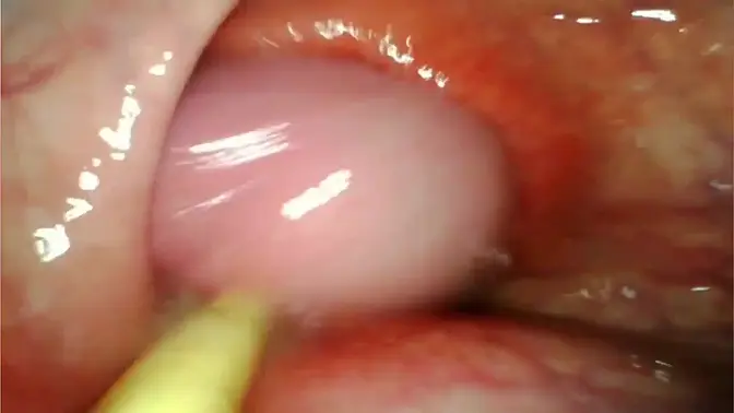 Amateur anal queen takes my fat dick in her tight pussy