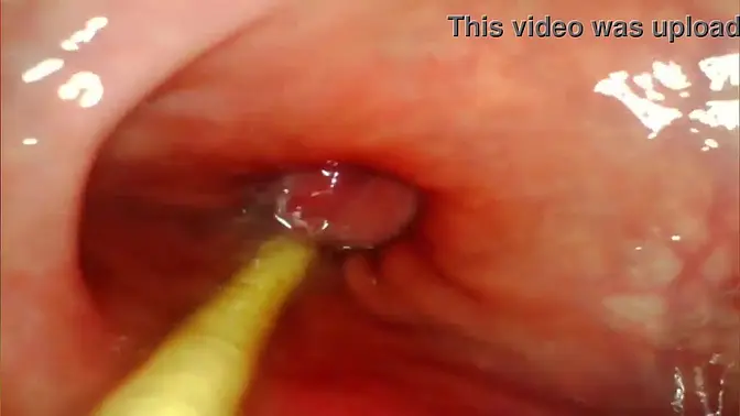 Anal Queen takes a deep pounding and creampied