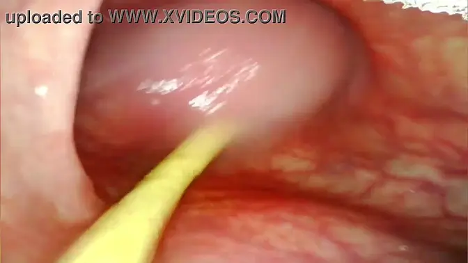 Big Cock Pounds Anal Slut's Gaping Ass Creampie