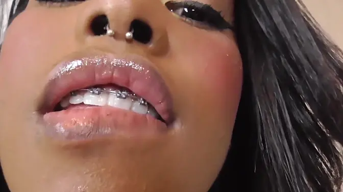 Black girl teeth brace fetish!