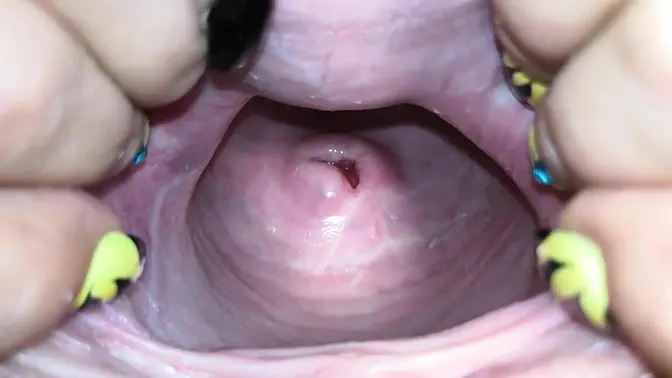 Cervix close up [4k]