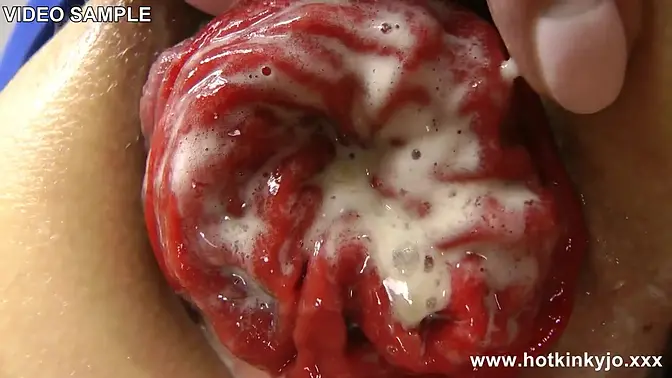 Extreme anal fisting and prolapse with beauties in blue dresses