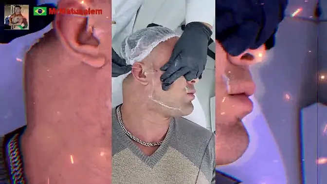 Motivation I transformed myself with facial harmonization see the result